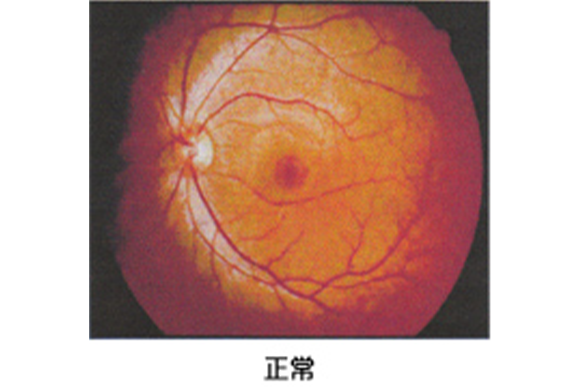 医療法人社団 磯久クリニック　眼底写真