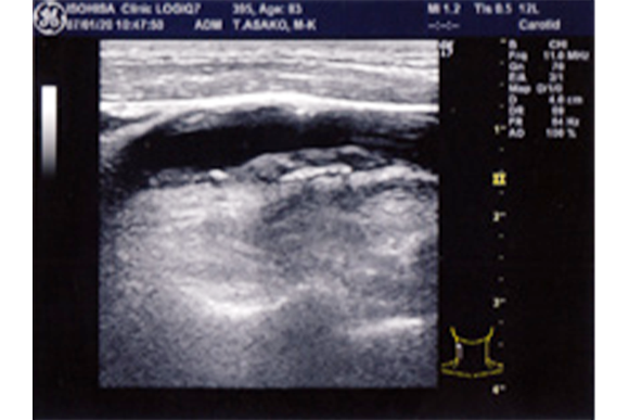 医療法人社団 磯久クリニック　超音波検査